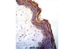 Immunohistochemistry (IHC) image for anti-Kallikrein 7 (KLK7) antibody (ABIN3002618) (Kallikrein 7 Antikörper)