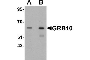 Western blot analysis of GRB10 in SK-N-SH cell lysate with GRB10 antibody at (A) 1 and (B) 2 µg/mL. (GRB10 Antikörper  (C-Term))