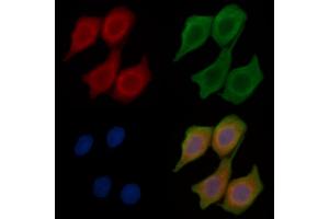 ABIN6259817 and ABIN6268680 staining Hela cells(45 min of heat-shock treatment) by IF/ICC.
