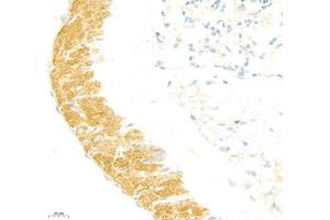 Immunohistochemistry (Paraffin-embedded Sections) (IHC (p)) image for anti-Collagen, Type V (COL5) antibody (ABIN7073547)