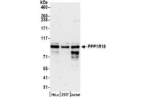 anti-KIAA1949 (KIAA1949) (AA 325-375) antibody