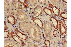 Immunohistochemistry (IHC) image for anti-Proteasome (Prosome, Macropain) 26S Subunit, Non-ATPase, 9 (PSMD9) (AA 103-150), (Regulatory Subunit 9) antibody (ABIN7142222)