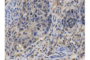 Immunohistochemistry (IHC) image for anti-Calcium/calmodulin-Dependent serine Protein Kinase (MAGUK Family) (CASK) antibody (ABIN1871447) (CASK Antikörper)