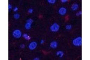 Immunofluorescence analysis of Rat liver tissue using Phospho-Pan-Akt (Ser473) Polyclonal Antibody at dilution of 1:200 (AKT1 Antikörper  (pSer473))