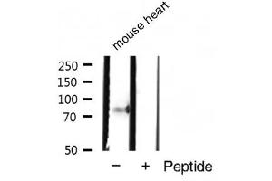 Western blot analysis of Phospho-STAT4 (Tyr693) expression in Mouse heart tissue lysate (STAT4 Antikörper  (pTyr693))