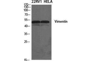 Western Blot (WB) analysis of specific cells using Vimentin Polyclonal Antibody. (Vimentin Antikörper  (Tyr317))