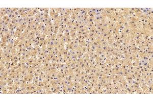Immunohistochemistry (IHC) image for anti-Coagulation Factor VIII (F8) (AA 2253-2346) antibody (ABIN7434263)
