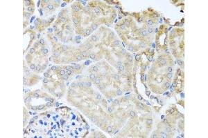 Immunohistochemistry of paraffin-embedded Mouse kidney using MYLK Polyclonal Antibody at dilution of 1:100 (40x lens). (MYLK Antikörper)