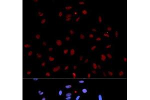 Immunofluorescence analysis of U2OS cells using Phospho-MET(Y1235) Polyclonal Antibody (c-MET Antikörper  (pTyr1235))
