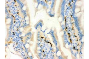 IHC analysis of FABP4 using anti-FABP4 antibody (ABIN3043827).