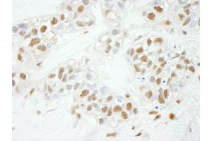 Immunohistochemistry (IHC) image for anti-Nuclear Transcription Factor Y, gamma (NFYC) (AA 408-458) antibody (ABIN7448691)