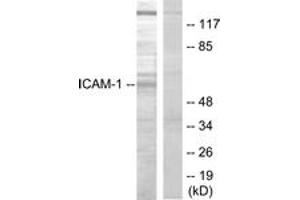 Western blot analysis of extracts from HepG2 cells, using ICAM-1 (Ab-512) Antibody.