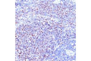 Immunohistochemistry of paraffin-embedded rat spleen using TC10/RHOQ Rabbit mAb (ABIN7269869) at dilution of 1:100 (40x lens). (RHOQ Antikörper)