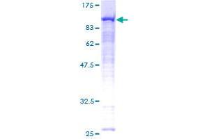 Radixin Protein (RDX) (AA 1-583) (GST tag)