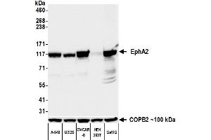 Western Blotting (WB) image for anti-EPH Receptor A2 (EPHA2) (AA 25-534) antibody (ABIN7452579)
