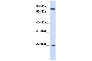 WB Suggested Anti-IFNA7 Antibody Titration: 0. (IFNA7 Antikörper  (N-Term))