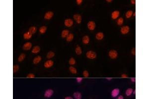 Immunofluorescence analysis of C6 cells using IPO8 Polyclonal Antibody at dilution of 1:100. (Importin 8 Antikörper)