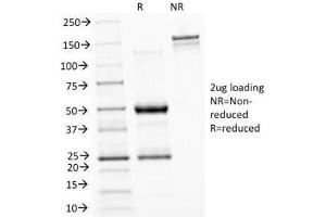 SDS-PAGE Analysis of Purified, BSA-Free ASRGL1 Antibody (clone CRASH/1289). (ASRGL1 Antikörper)