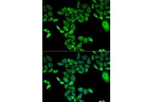 Immunofluorescence analysis of A-549 cells using FMO3 antibody (ABIN3015685, ABIN3015686, ABIN3015687 and ABIN6219039). (FMO3 Antikörper  (AA 263-532))