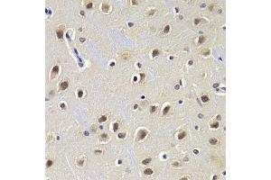 Immunohistochemistry of paraffin-embedded rat brain using CDKN1B Antibody. (CDKN1B Antikörper)