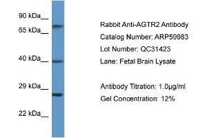Western Blotting (WB) image for anti-Angiotensin II Receptor, Type 2 (AGTR2) (N-Term) antibody (ABIN2788290) (Angiotensin II Type 2 Receptor Antikörper  (N-Term))