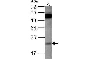 WB Image Sample (30 ug of whole cell lysate) A: HCT116 12% SDS PAGE antibody diluted at 1:500