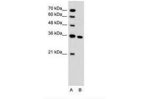 SLC25A29 Antikörper  (C-Term)