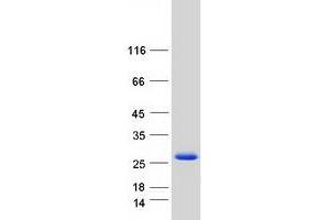 Validation with Western Blot (m1ip1 Protein (Transcript Variant 3) (Myc-DYKDDDDK Tag))
