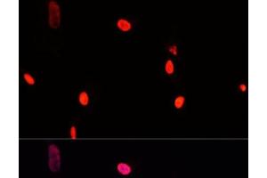 Immunofluorescence analysis of A431 cells using GTF2I Polyclonal Antibody at dilution of 1:100. (GTF2I Antikörper)