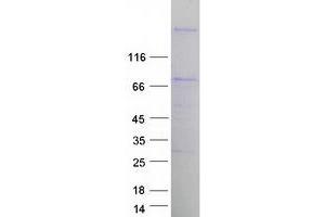 Validation with Western Blot (SPHKAP Protein (Transcript Variant 2) (Myc-DYKDDDDK Tag))