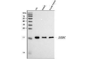 Western blot analysis of U1-C/SNRPC using anti-U1-C/SNRPC antibody (ABIN7599016).