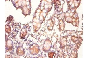 Immunohistochemistry of paraffin-embedded human small intestine tissue using ABIN7148869 at dilution of 1:100 (CDK2AP1 Antikörper  (AA 1-115))
