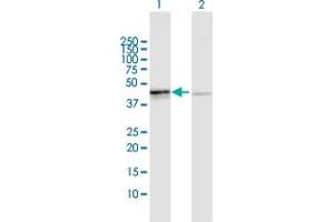 Western Blot analysis of OXA1L expression in transfected 293T cell line by OXA1L MaxPab polyclonal antibody. (OXA1L Antikörper  (AA 1-435))