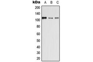 Western blot analysis of Desmoglein 4 expression in HEK293T (A), SP2/0 (B), H9C2 (C) whole cell lysates.