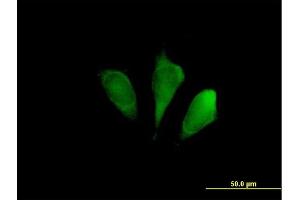 Immunofluorescence of purified MaxPab antibody to FBXO9 on HeLa cell. (FBXO9 Antikörper  (AA 1-437))