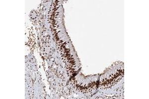 Immunohistochemical staining of human nasopharynx with ZNF638 polyclonal antibody  shows strong nuclear positivity in respiratory epithelial cells. (ZNF638 Antikörper)
