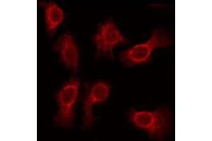 ABIN6275615 staining Hela by IF/ICC. (SVOP Antikörper  (Internal Region))
