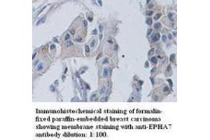 Image no. 1 for anti-EPH Receptor A7 (EPHA7) (C-Term) antibody (ABIN791047) (EPH Receptor A7 Antikörper  (C-Term))