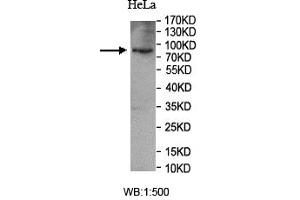 Western blot analysis of HeLa cell lysate, using SUN1 antibody. (SUN1 Antikörper  (AA 22-173))