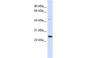 WB Suggested Anti-FAM119A Antibody Titration: 0.