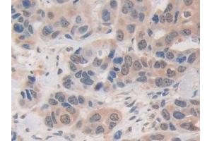 Immunohistochemistry (IHC) image for anti-Ubiquitin Specific Peptidase 7 (Herpes Virus-Associated) (USP7) (AA 54-507) antibody (ABIN7443551)