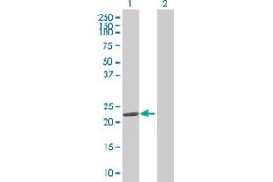Western Blot analysis of DHFR expression in transfected 293T cell line by DHFR MaxPab polyclonal antibody.