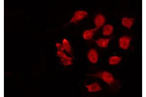 ABIN6269043 staining HeLa by IF/ICC. (CHEK1 Antikörper  (Internal Region))