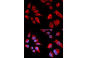 Immunofluorescence analysis of U2OS cells using CBS antibody. (CBS Antikörper  (AA 252-551))