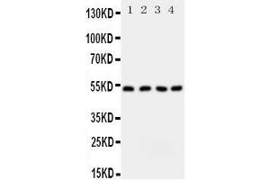 Western Blotting (WB) image for anti-serine Palmitoyltransferase, Long Chain Base Subunit 1 (SPTLC1) (AA 138-154), (Middle Region) antibody (ABIN3043056) (SPTLC1 Antikörper  (Middle Region))