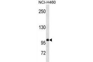Western Blotting (WB) image for anti-General Transcription Factor IIIC, Polypeptide 3, 102kDa (GTF3C3) antibody (ABIN3000897) (GTF3C3 Antikörper)