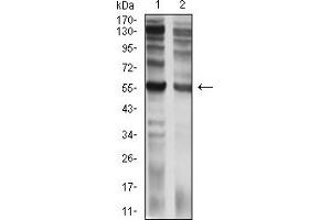 IL9 Receptor Antikörper  (AA 41-270)