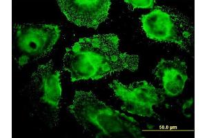 Immunofluorescence of monoclonal antibody to MRPL12 on HeLa cell. (MRPL12 Antikörper  (AA 1-198))