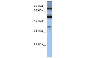 INPP5B antibody used at 1 ug/ml to detect target protein. (INPP5B Antikörper  (Middle Region))