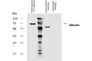 Western blotting analysis of human serum albumin using mouse monoclonal antibody AL-01 on human plasma and lysate of HeLa cell line (albumin non-expressing cell line, negative control) under non-reducing and reducing conditions. (Albumin Antikörper  (Biotin))